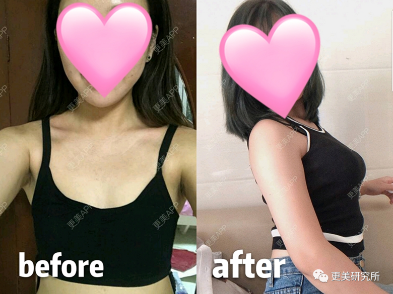 继宋祖儿催吐疤痕都露出后，泫雅热巴的尤物身材是这样来的？
