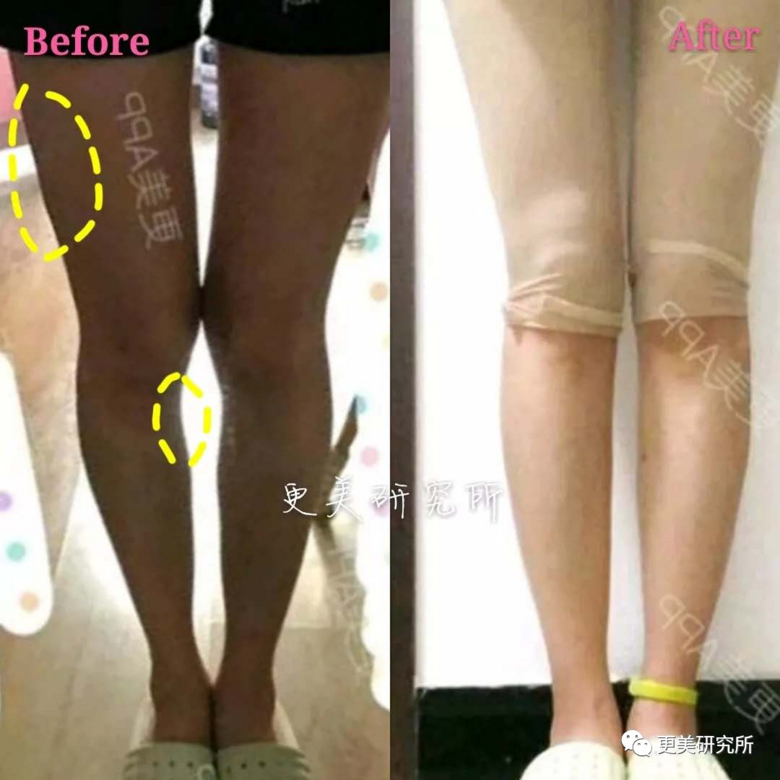 继宋祖儿催吐疤痕都露出后，泫雅热巴的尤物身材是这样来的？