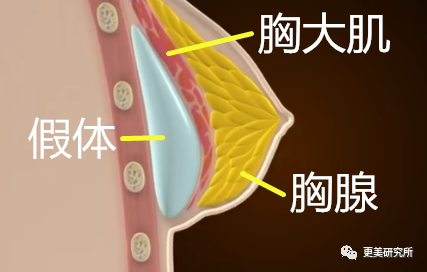继宋祖儿催吐疤痕都露出后，泫雅热巴的尤物身材是这样来的？