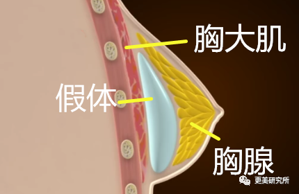 继宋祖儿催吐疤痕都露出后，泫雅热巴的尤物身材是这样来的？