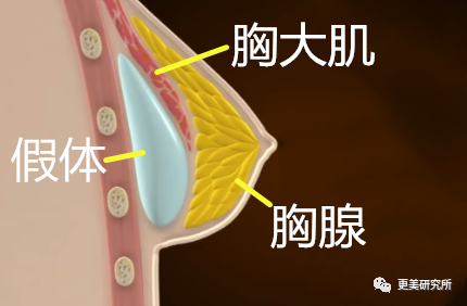 继宋祖儿催吐疤痕都露出后，泫雅热巴的尤物身材是这样来的？
