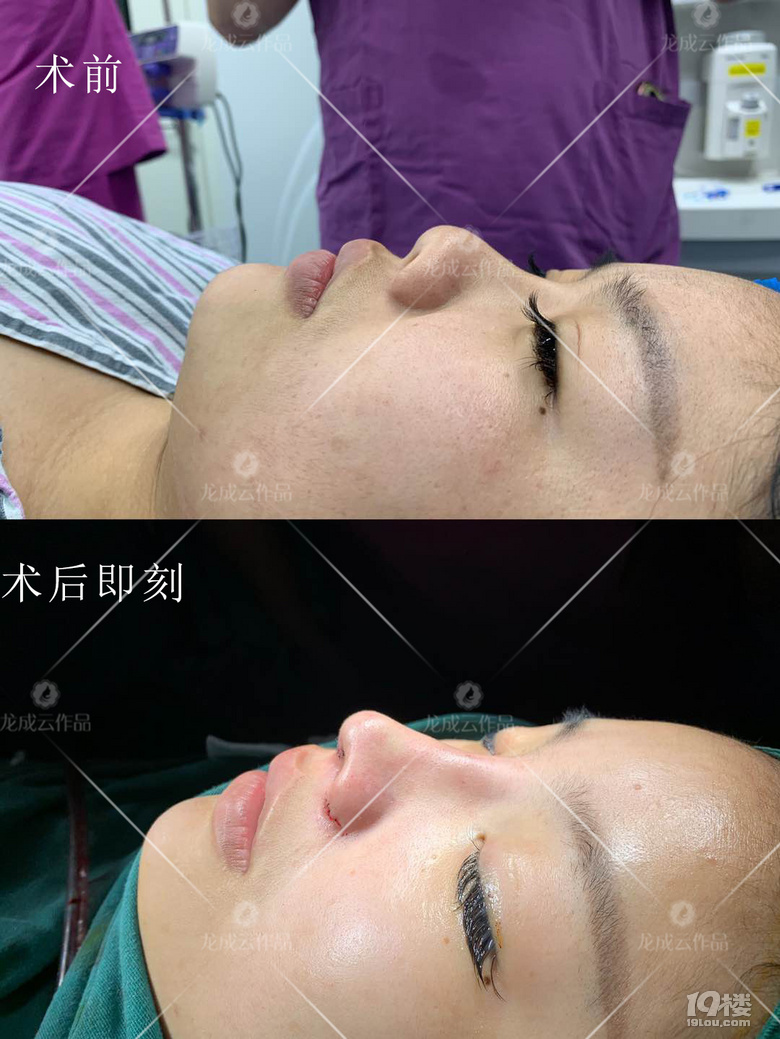 怎么样才能让鼻子变好看呢？