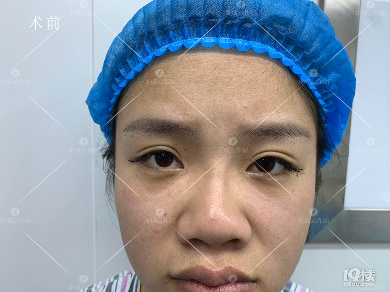 怎么样才能让鼻子变好看呢？