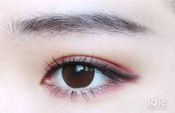 修复失败双眼皮技术?双眼皮修复还你健康动人双眼!