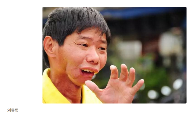 太囂張!檳榔致癌,2萬多人被割臉,“封殺”都沒用,威脅買醫(yī)生