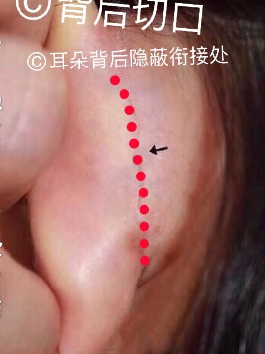 ˵ıǾCg(sh)䌍(sh)ě](mi)ô