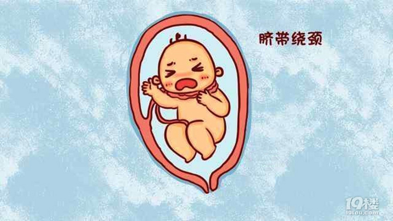 要想胎寶遠(yuǎn)離臍帶繞頸,孕媽要改正這4種不良習(xí)慣!