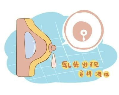 相信直覺乳頭變硬52歲湖州阿姨總懷疑自己有病醫生髮