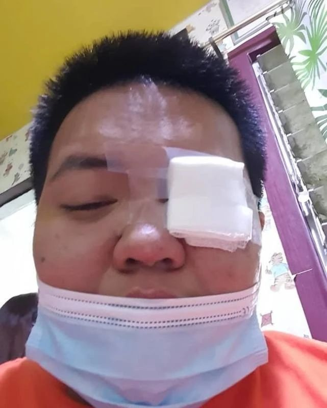 松狮踩伤主人眼睛后不见了,主人:它觉得对不起我