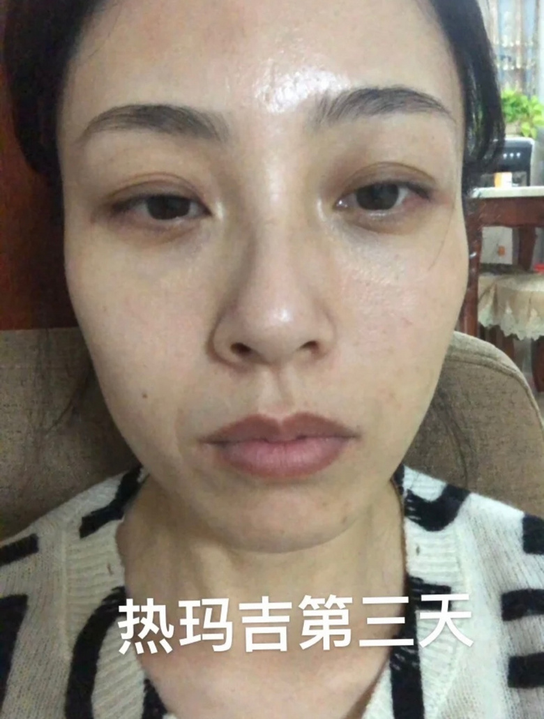 ʮğᬔF(xin)20Kڿ(li)c(din)Ч