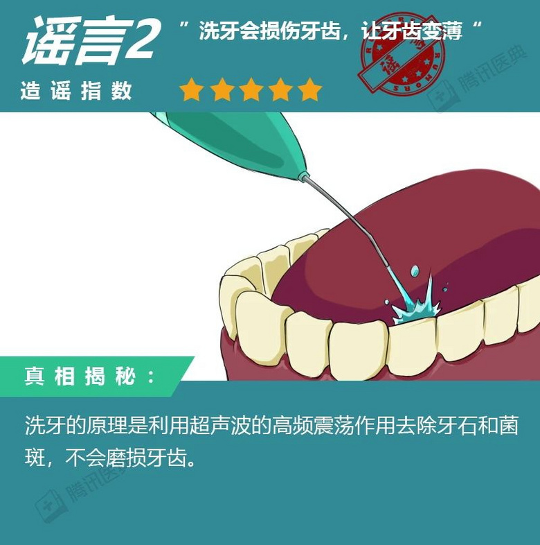 洗牙會不會傷牙?洗牙的8大傳言,據說99%的中國人都信了