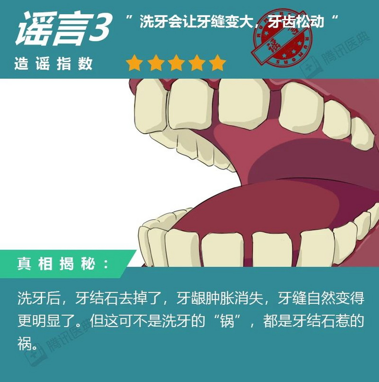 洗牙會不會傷牙?洗牙的8大傳言,據說99%的中國人都信了