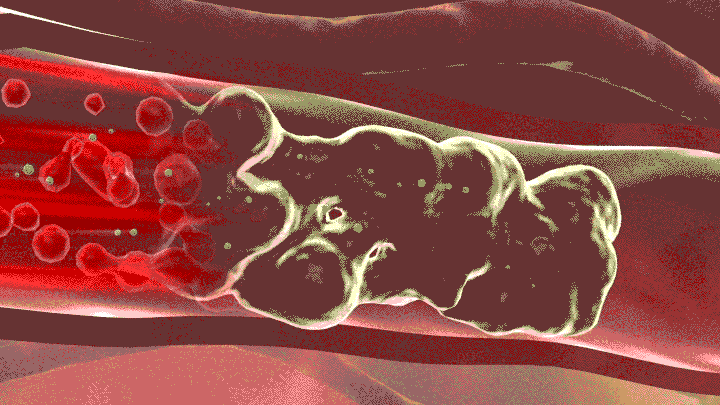 ÿ(g)˶һѪܡ˸