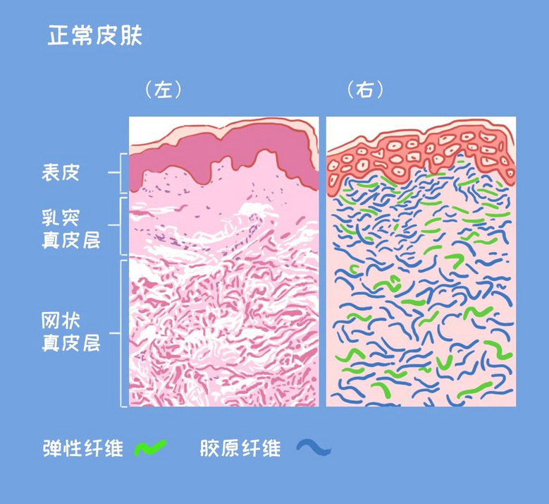 身上的这种纹，没怀孕也会有，4招可改善