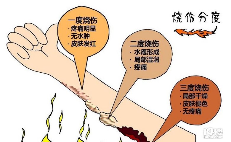 痛心!杭州电动车自燃,烧伤急救、烧伤康复该怎么做?