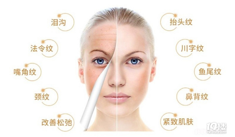 脂肪填充泪沟一周图片，特期待脂肪填充泪沟多久恢复自然~
