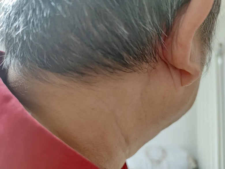 他们用半生时间等待失明