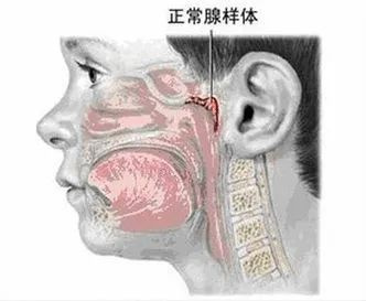 娃睡覺(jué)張嘴?越長(zhǎng)越丑?很多小孩都有的腺樣體肥大,一文說(shuō)清!