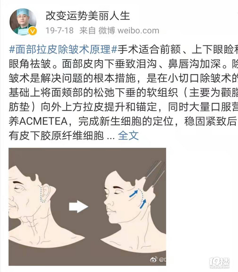 探究面部拉皮可以做几次，面部拉皮手术可以保持多久~
