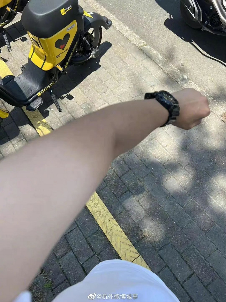 杭州夏天的太阳有多毒男子来杭仅一天晒出手臂分界线