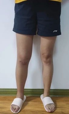 醫(yī)生樂呵呵“玩”著我的腿:這樣,這樣,哎,都沒事!