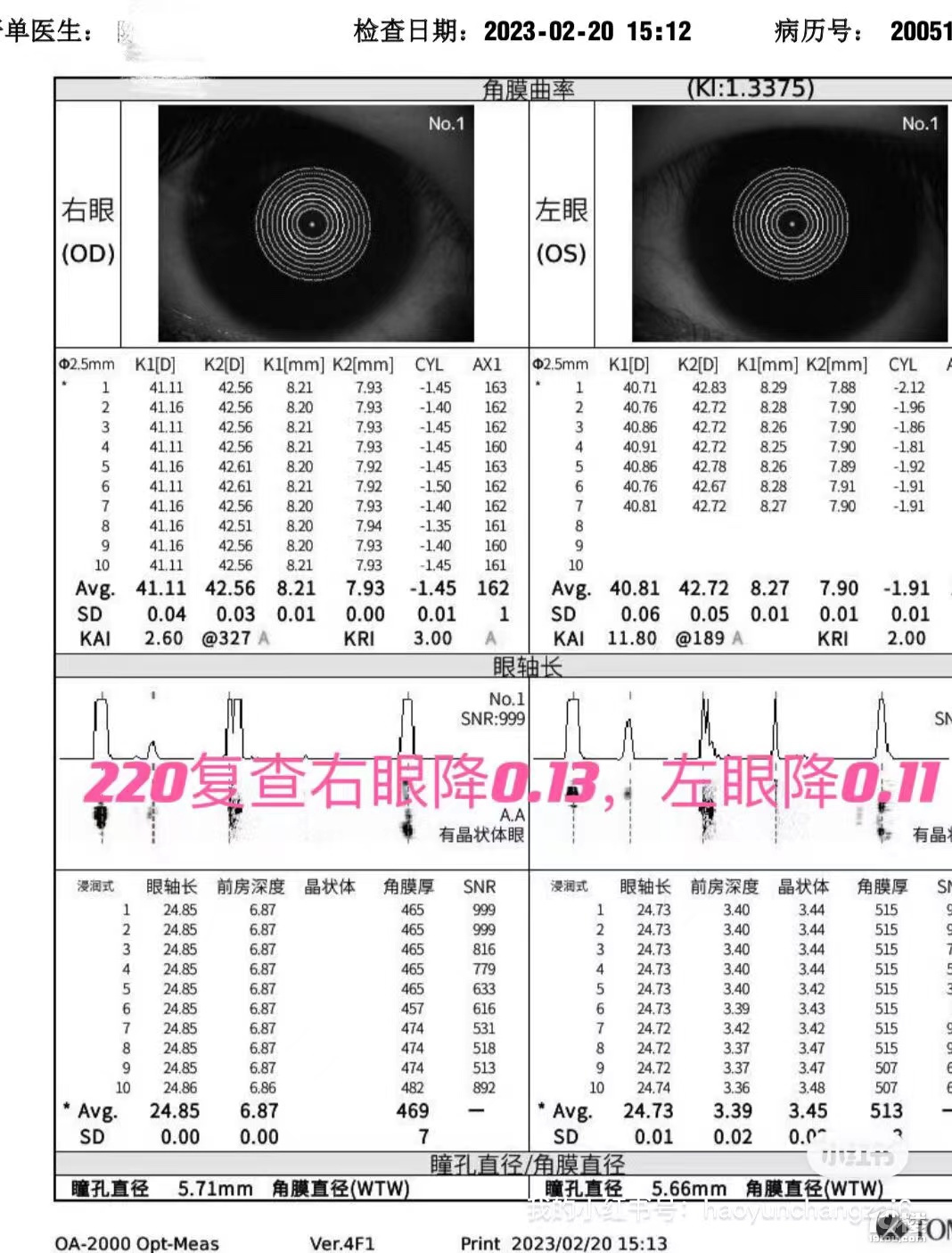 三个月降轴0.25 负增长75度 近视不可逆？