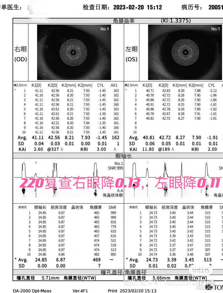 三个月降轴0.25 负增长75度 近视不可逆？