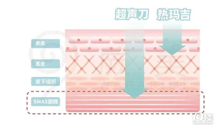 盘点下超 声刀适合多大年龄做，超 声刀美容后注意事项~
