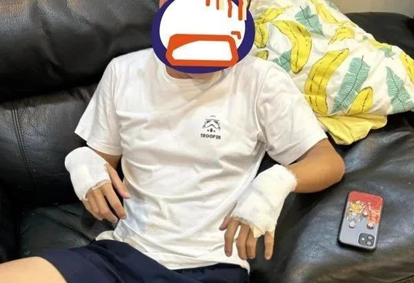 小哥制止狗子打架受傷,親媽得知后卻只說(shuō):我家小狗好可憐