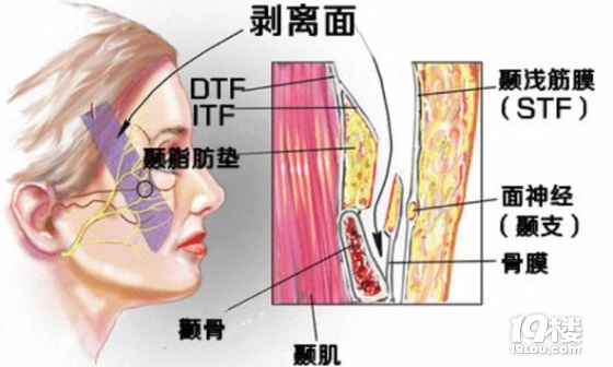 知识篇：smas筋膜悬吊术、额肌悬吊术能维持多久