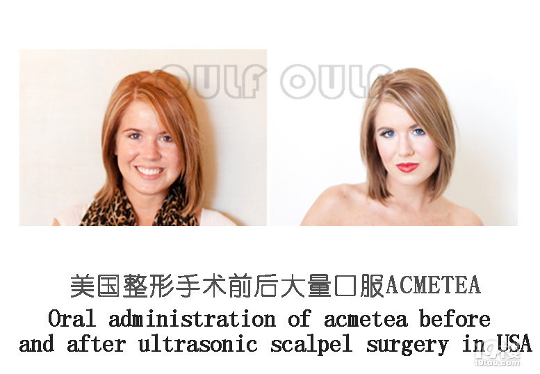 超声炮多久可以做第二次、超声炮多久打一次、看完秒懂~