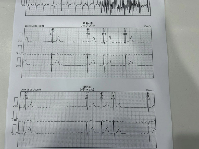 ����ʱ��ֲ������Ϊ��Ѯ�ϲ��������ݻ���~