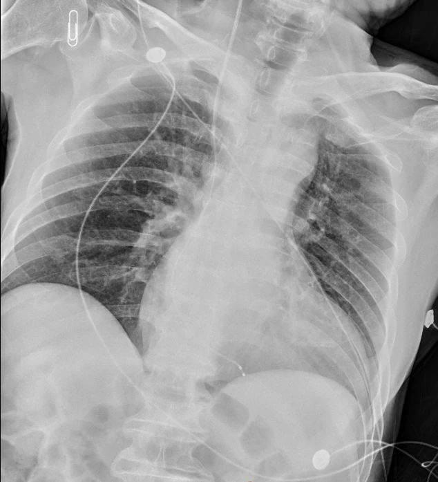 ����ʱ��ֲ������Ϊ��Ѯ�ϲ��������ݻ���~