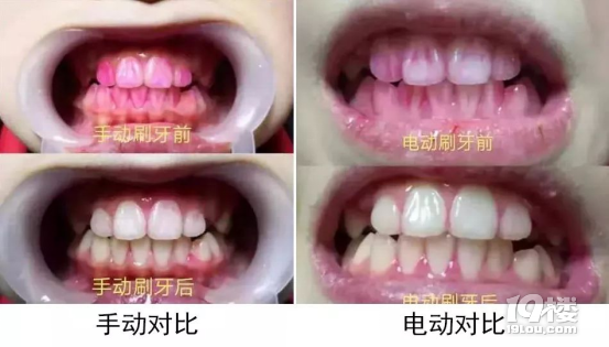 电动牙刷怎么选三大黑名单重灾区切勿踩雷