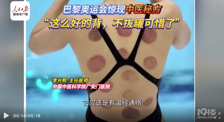 为何游泳选手都爱拔火罐？医生：缓解疼痛还能加速组织修复