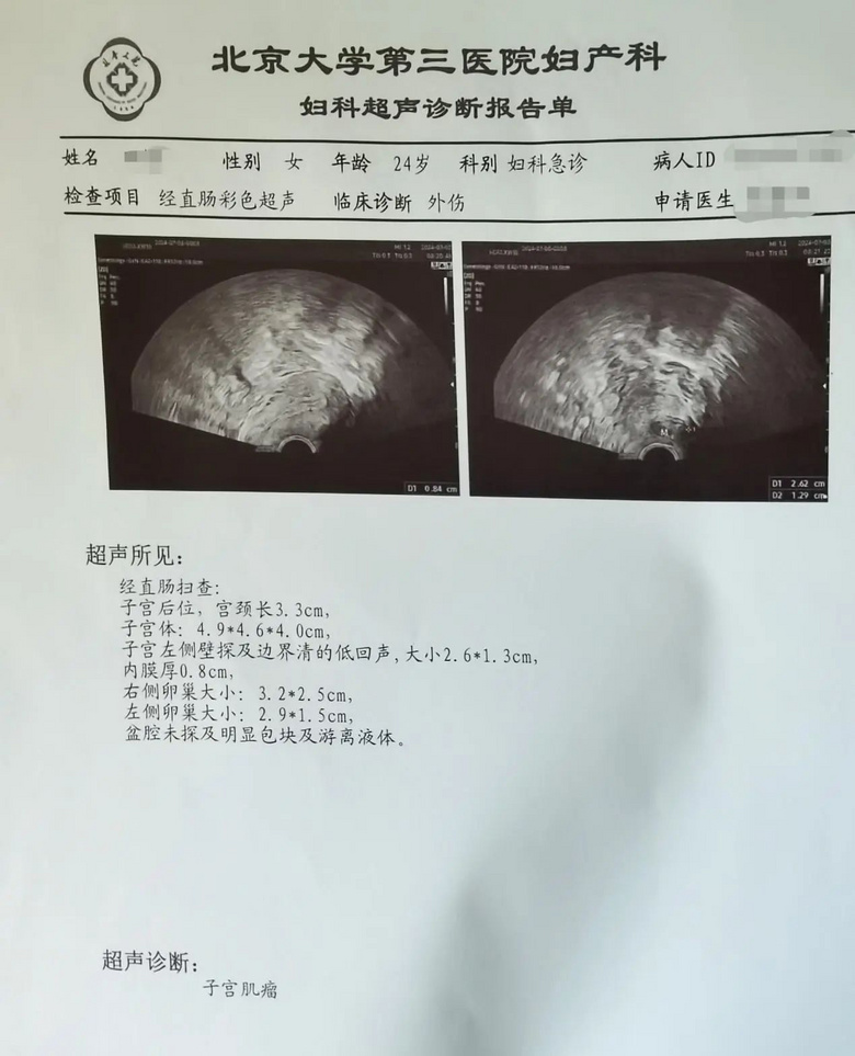 觀鳥時(shí)被絆倒,我一屁股杵在了柵欄的木頭尖尖上