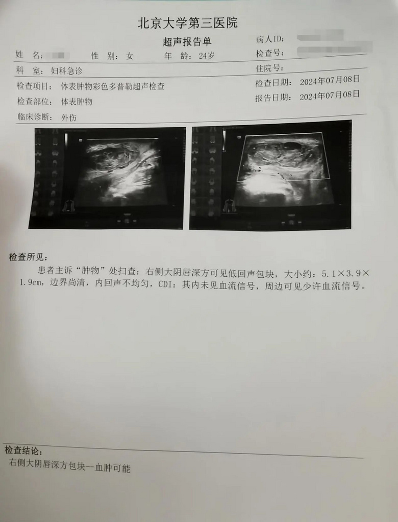 觀鳥時(shí)被絆倒,我一屁股杵在了柵欄的木頭尖尖上