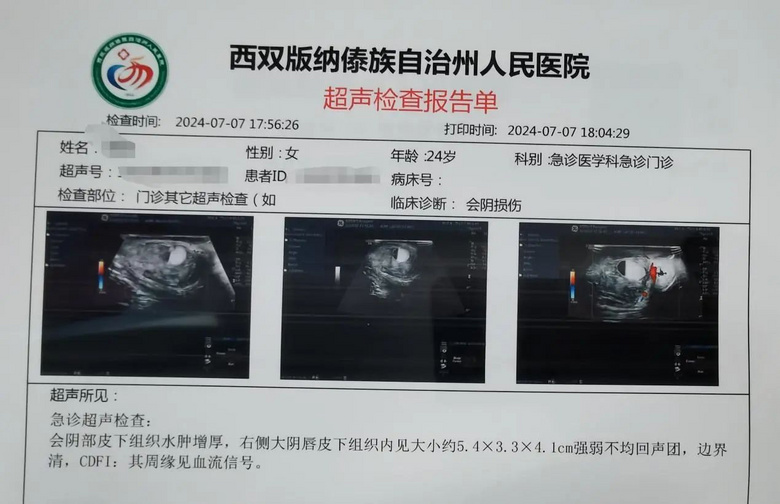 觀鳥時(shí)被絆倒,我一屁股杵在了柵欄的木頭尖尖上