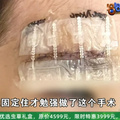 3岁女童在托育园摔破头，缝13针！园方“要让孩子暴露在危险中”_图5