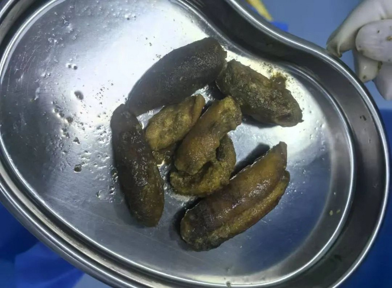 Ă¶cס
