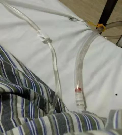 切肺之前,我拿出当年临摹的解剖图学习了一下