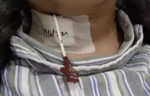 切肺之前,我拿出当年临摹的解剖图学习了一下