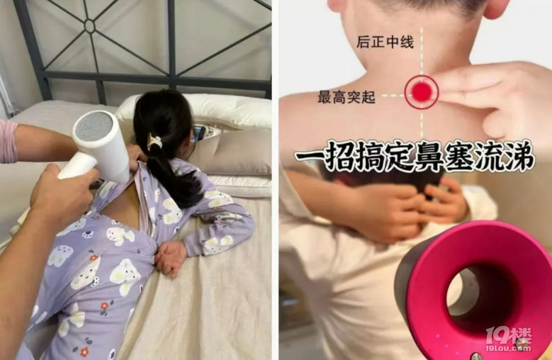 一招搞定鼻塞流涕？奶奶懊悔：5岁孙子深度烧伤