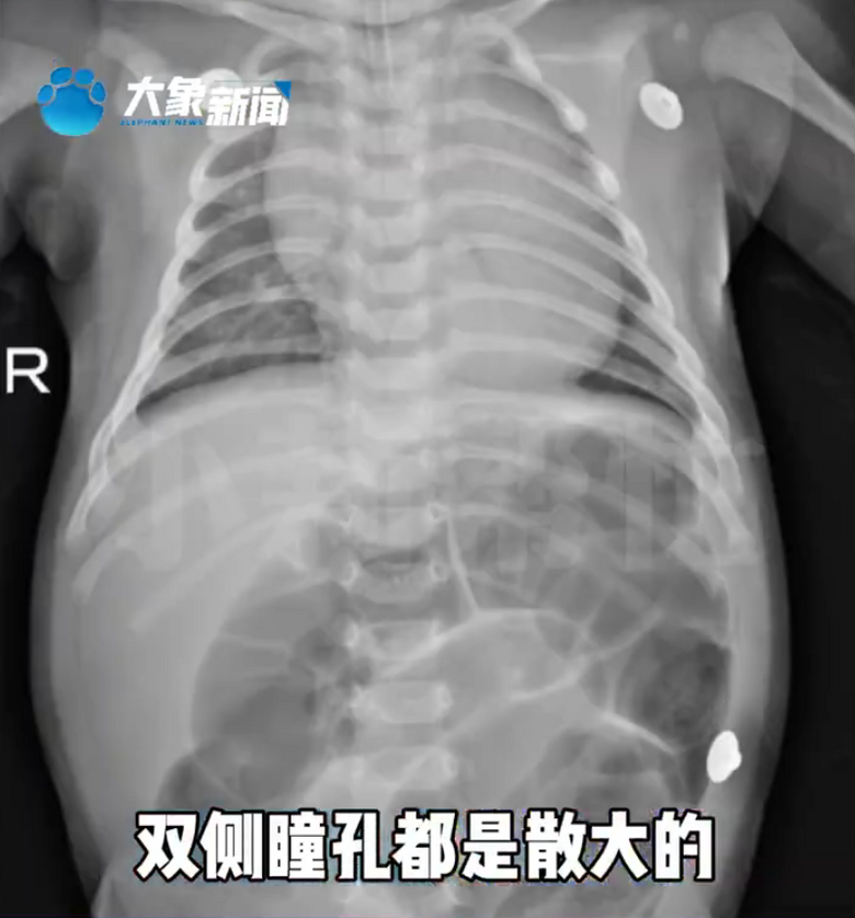 52쌚жM(jn)ICUֻˡt(y)o