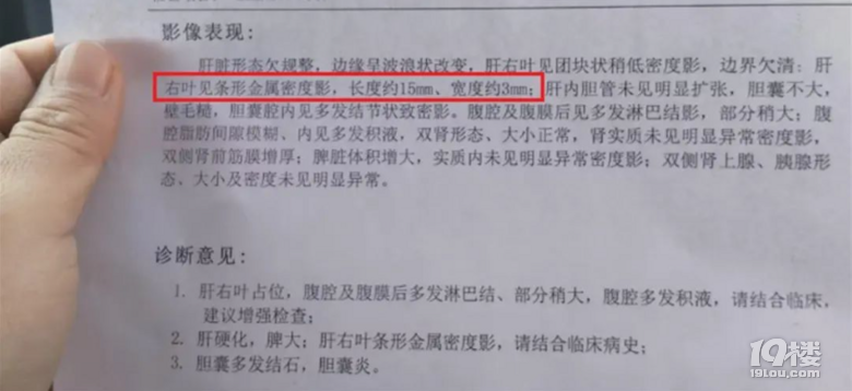 男子做完手術(shù)后被告知針頭落在體內(nèi)且無(wú)法取出?多方回應(yīng)!