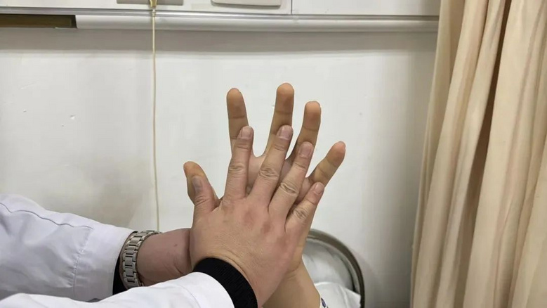 16歲男孩身高瘋長(zhǎng)到199cm!檢查后發(fā)現(xiàn)體內(nèi)長(zhǎng)了個(gè)……