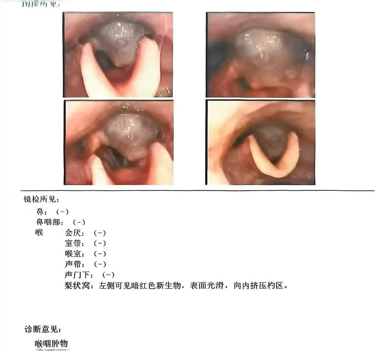 我從小吞藥困難、吃東西經(jīng)常噎住,可能都和這顆“血管炸彈”有關