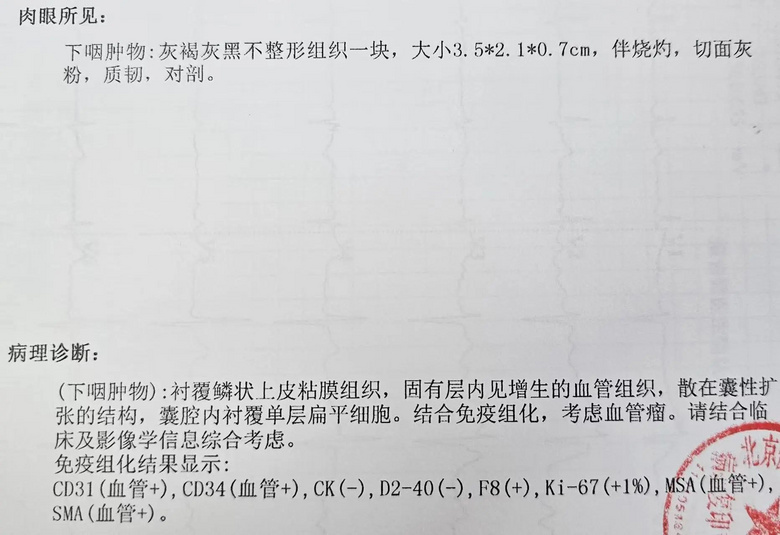 我從小吞藥困難、吃東西經(jīng)常噎住,可能都和這顆“血管炸彈”有關