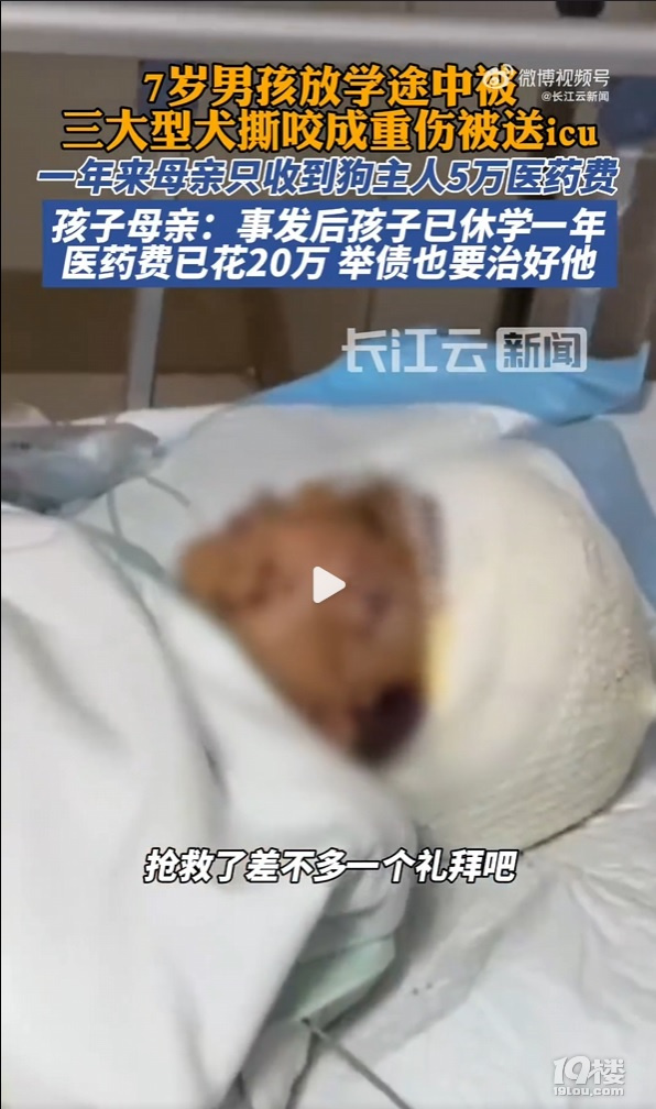 7岁男孩上学途中被三大型犬撕咬面目全非