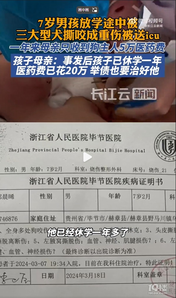 7岁男孩上学途中被三大型犬撕咬面目全非
